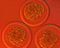 ÐÔ¿ØÅßÌ¥.jpg ÐÔ¿ØÅßÌ¥.jpg